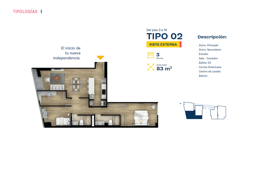 Tipo 2 (Modelo B)