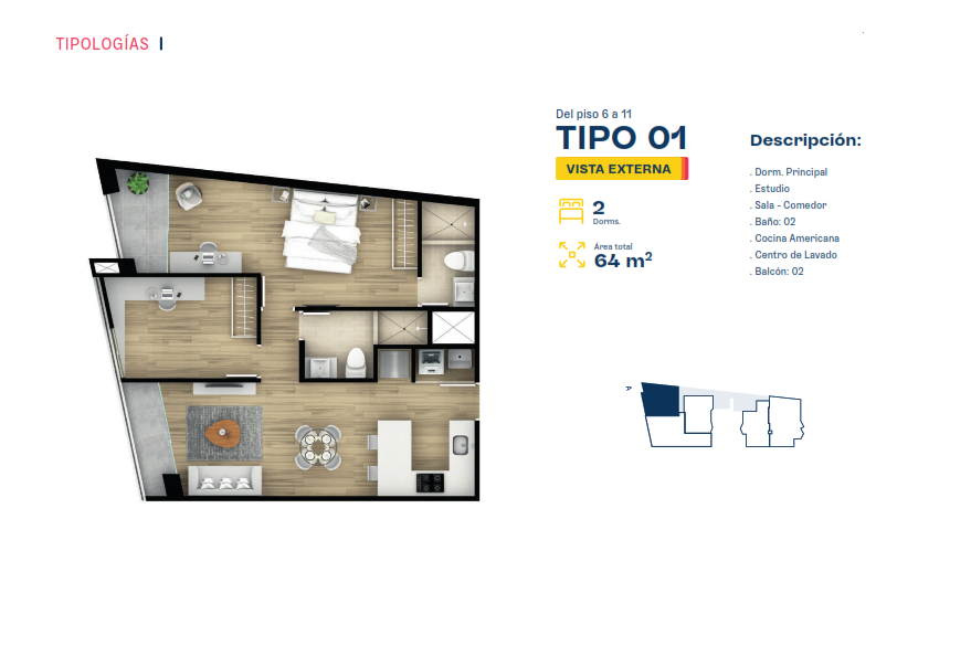 Tipo 1 (Modelo A)